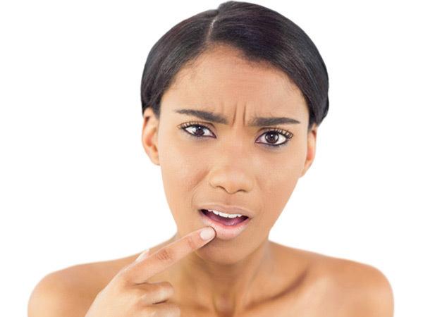 Loại bỏ các mụn rộp: Sự xuất hiện của mụn rộp là do virus herpes đơn dạng type 1 gây nên. Khoảng 90% số người trên PG88.com Game Bài đều có loại virus này nhưng ở dạng không hoạt động. Khi môi tiếp xúc với ánh nắng quá nhiều hoặc khi bạn bị ốm hay căng thẳng, chúng mới nổi lên thành các mụn rộp. Để loại bỏ các mụn rộp “đáng ghét” này bạn có thể sử dụng thuốc mỡ hay kem có thành phần từ chanh.