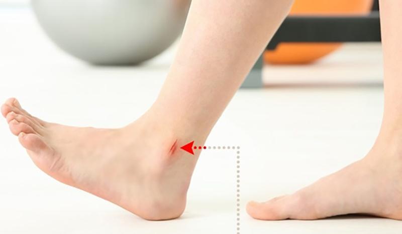 Bệnh tiểu đường: Khi bị tiểu đường, ngay cả những vết thương nhỏ nhất ở chân cũng có thể gây ra hậu quả nghiêm trọng. Bệnh này thường đi kèm với tổn thương thần kinh. Người bệnh thường không có cảm giác đau và không hề nhận ra một vết bầm nhỏ có thể biến thành vết loét.