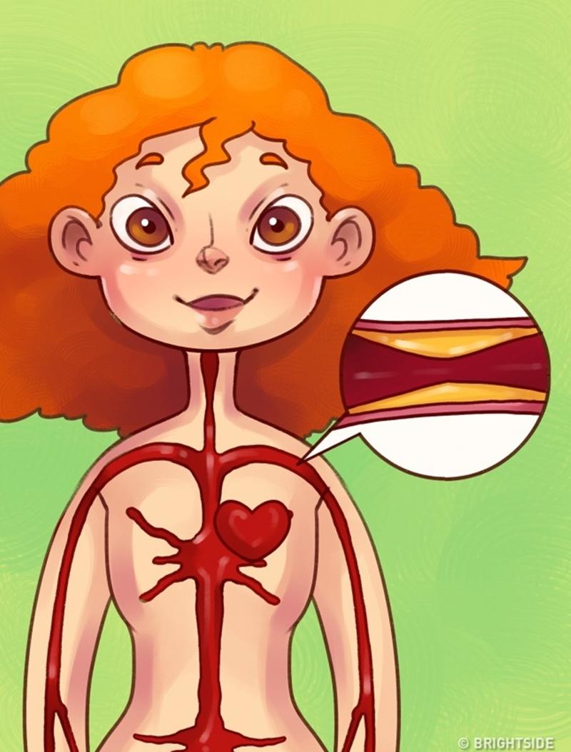Không ăn thịt đồng nghĩa với mức cholesterol trong máu sẽ giảm. Những người bị xơ vữa động mạch được các bác sĩ khuyến cáo nên chọn chế độ ăn rau củ phù hợp.