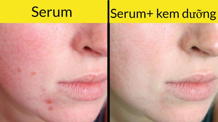 Serum (huyết thanh) nên được sử dụng trước khi bạn dùng kem dưỡng ẩm cho da. Và tốt hơn là nên dùng serum vào buổi tối, đặc biệt khi serum có chứa retinol. Điều này sẽ cho phép da hấp thụ đầy đủ các chất dinh dưỡng cần thiết. Vào mùa Hè, các sản phẩm giàu retinol sẽ làm cho da nhạy cảm với ánh nắng mặt trời và có thể gây ra cháy nắng, do vậy bạn nhất thiết phải sử dụng kem chống nắng.