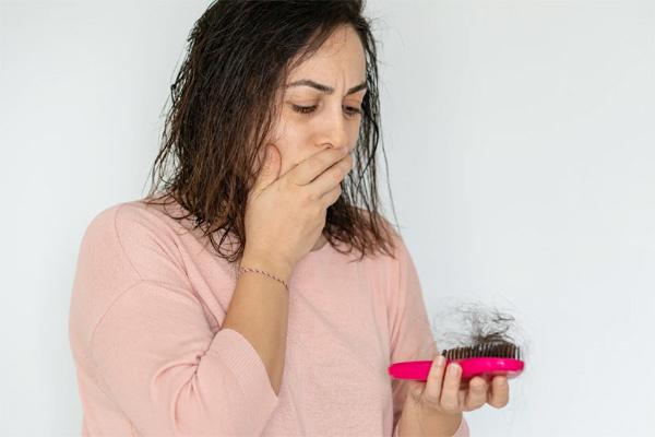 Mất quá nhiều tóc khiến người mắc Covid-19 vẫn lo lắng dù đã âm tính nCoV.