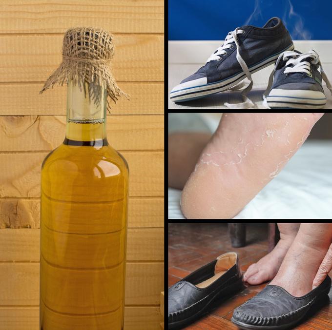 Trị mùi hôi, chân bóng da hay nứt nẻ  Giấm táo có tác dụng hữu hiệu trong việc khử mùi, tẩy tế bào chết và làm mềm da chân. Trộn một phần giấm với hai phần nước nóng, ngâm chân trong khoảng 15 phút rồi lau sạch và thoa kem dưỡng.