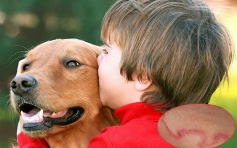 Tránh xa động vật lạ: Nhiễm trùng có thể lây lan từ động vật sang người. Nếu gia đình có vật nuôi, cần đảm bảo chúng được tiêm đầy đủ và kiểm tra sức khỏe thường xuyên.