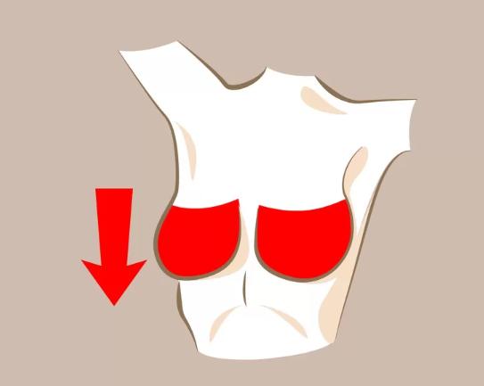 Bầu ngực chảy xệ.  Đây cũng là một hiện tượng dễ gặp trong quá trình lão hóa hoặc sau khi sinh con và cho con bú. Bạn có thể cải thiện bằng cách mặc áo ngực phù hợp, tập thể dục thường xuyên và massage nhẹ nhàng với kem làm săn chắc ngực