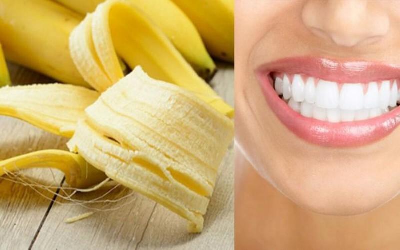 Chăm sóc răng miệng: Mỗi tối trước khi đi ngủ, bạn chà xát vỏ chuối chín lên răng chừng 5 phút rồi súc miệng với nước sạch, những mảng bám ố vàng trên răng sẽ biến mất.