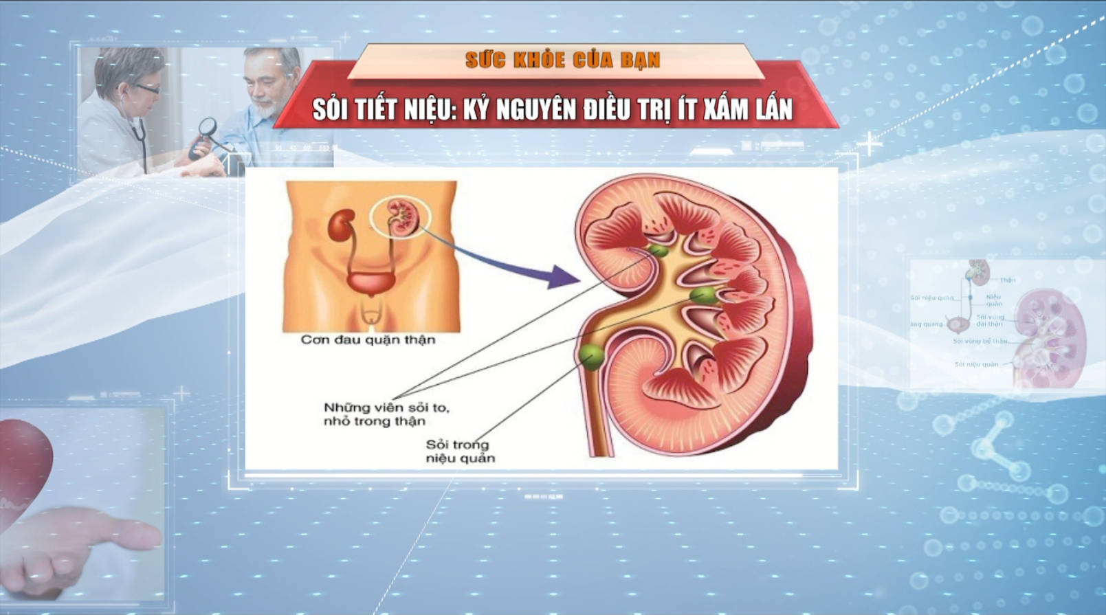 [🔴Trực tiếp] Sức khỏe của bạn: Sỏi tiết niệu: Kỷ nguyên điều trị ít xâm lấn